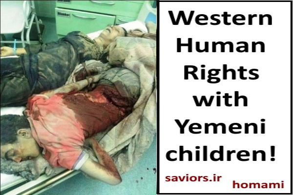 اطفال یمن