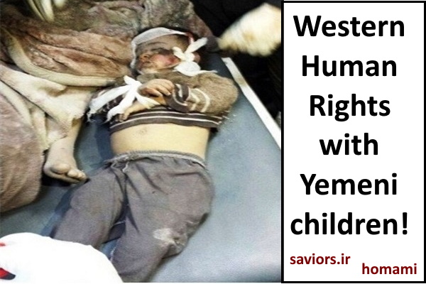 Children killed in Yemen, Human rights watch or oil power?